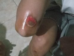 Diduga Akibat Limbah Pasir dan Minim PJU, Warga Sindangsari Jatuh di Jalan Nasional Desa Pancanegara Pabuaran