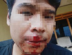 Pemilik Perusahaan Media sidikberita.com Cekcok Berujung Pengeroyokan, Korban Minta Pelaku  di Proses Hukum