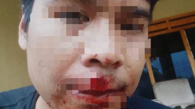 Pemilik Perusahaan Media sidikberita.com Cekcok Berujung Pengeroyokan, Korban Minta Pelaku  di Proses Hukum